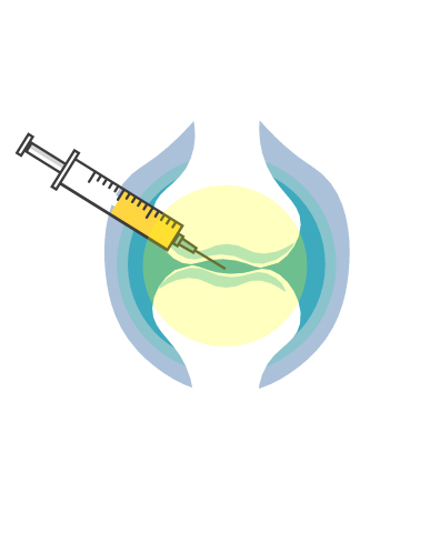 関節の変形を遅らせる